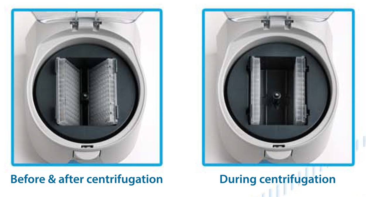 Before and After, and During Bioclave Mini Autoclave